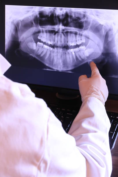 Best Emergency Tooth Extraction in Graymoor Devondale, KY