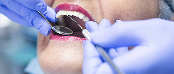 Best Emergency Wisdom Teeth Removal in Graymoor Devondale, KY